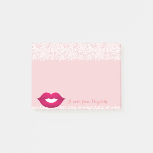 Cute Lovely Stylish Girly, Lace, Lips Post-it® Notes (Voorkant)