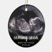 Cute Sonogram Foto Zwangerschap Kerstmis Keramisch Ornament (Links)