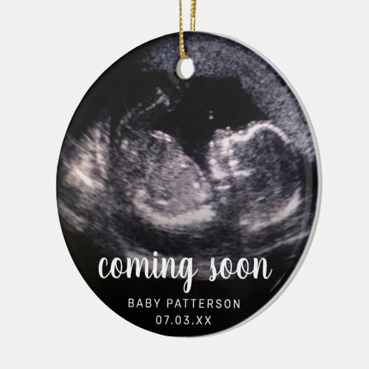 Cute Sonogram Foto Zwangerschap Kerstmis Keramisch Ornament (Links)