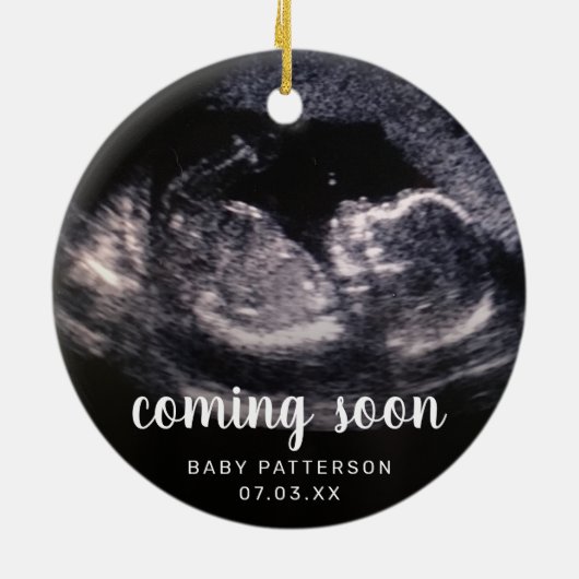Cute Sonogram Foto Zwangerschap Kerstmis Keramisch Ornament (Achterkant)