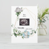 Cute Twins Ultrasound Bedankt Baby-gezichtspunt (Staand voorkant)