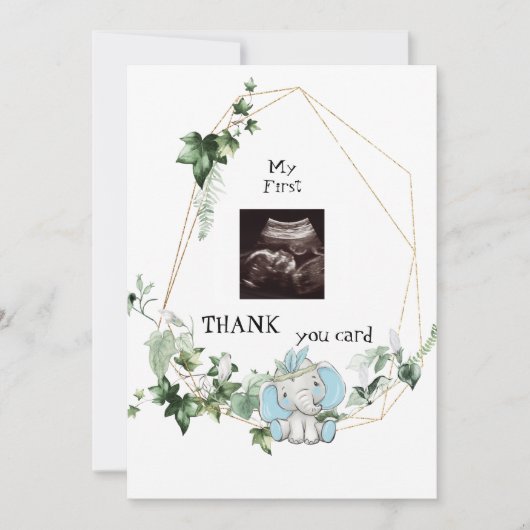 Cute Ultrasound Bedankt Baby Boy Viewpoint (Voorkant)