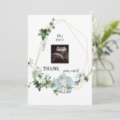 Cute Ultrasound Bedankt Baby Boy Viewpoint (Staand voorkant)