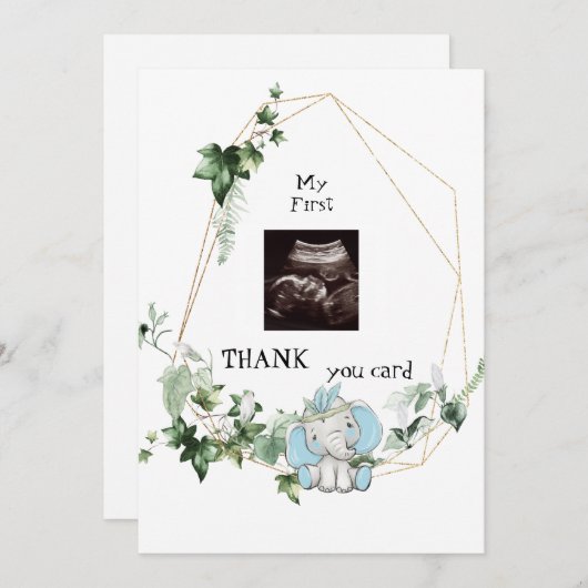 Cute Ultrasound Bedankt Baby Boy Viewpoint (Voorkant / Achterkant)