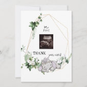 Cute Ultrasound Bedankt Baby Girl Viewpoint (Voorkant)