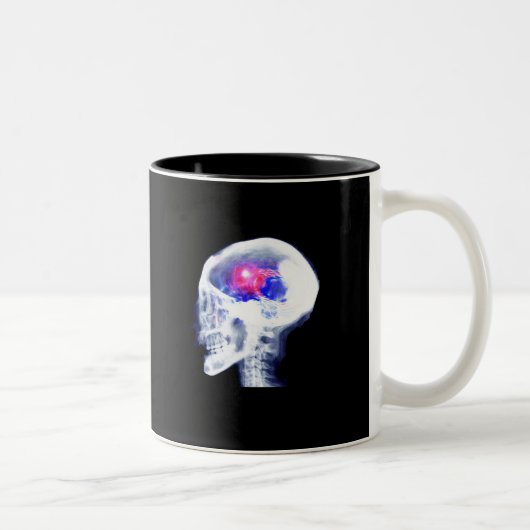 Cyborg Brain Tweekleurige Koffiemok (Rechts)