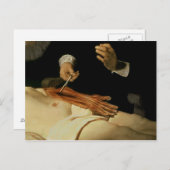 De Anatomy Lesson van Dr. Nicolaes Tulp, 1632 Briefkaart (Voorkant / Achterkant)
