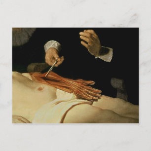 De Anatomy Lesson van Dr. Nicolaes Tulp, 1632 Briefkaart