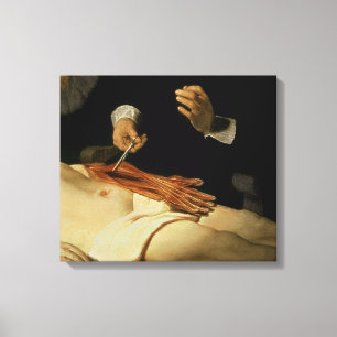 De Anatomy Lesson van Dr. Nicolaes Tulp, 1632 Canvas Afdruk