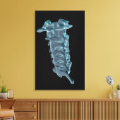 De cervicale wervels canvas afdruk (Insitu (Woonkamer))
