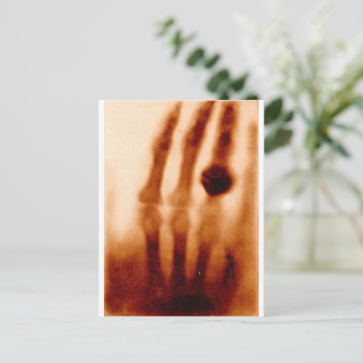 De eerste röntgenfoto van 1901 briefkaart (Staand voorkant)