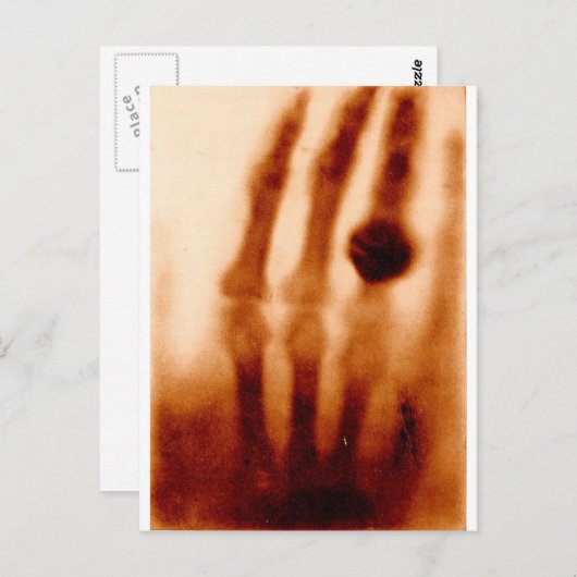 De eerste röntgenfoto van 1901 briefkaart (Voorkant / Achterkant)