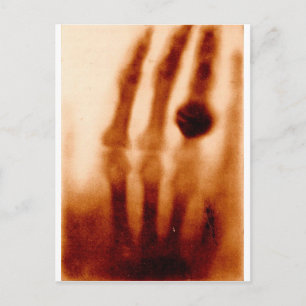 De eerste röntgenfoto van 1901 briefkaart