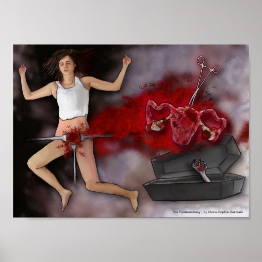 De hysterectomie poster (Voorkant)