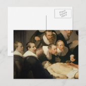 De les van de Anatomie van Dr. Nicolaes Tulp, 1632 Briefkaart (Voorkant / Achterkant)