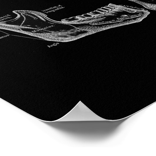 De menselijke schedel en de anatomische afdruk poster (Hoek)