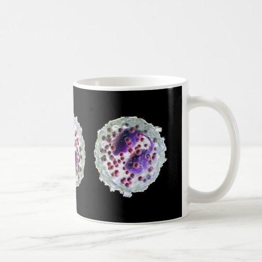 De Mok van de koffie - Eosinophilia (Rechts)