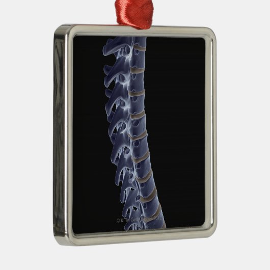 De wervelkolom 3 metalen ornament (Rechts)