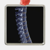 De wervelkolom 3 metalen ornament (Voorkant)