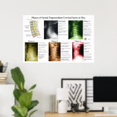 Degeneratie van de cervicale wervelkolom Chiroprac Poster (Thuiskantoor)