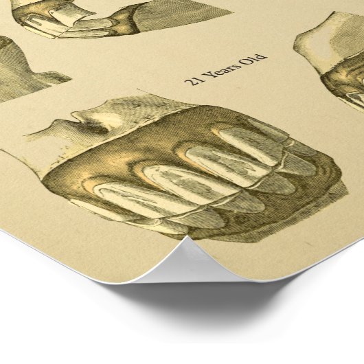 Dental Age of Horse Teeth Poster (Hoek)