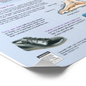 Diabetes Foot Care Poster - Netter Chart (Hoek)