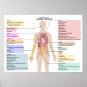 Diagram van de Manifestaties van cystische fibrose Poster (Voorkant)