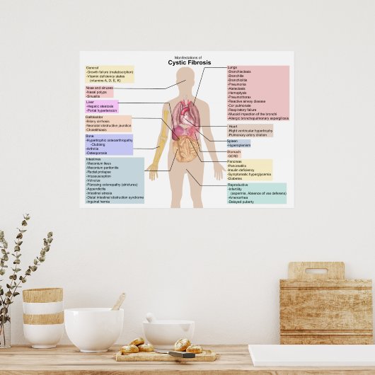 Diagram van de Manifestaties van cystische fibrose Poster (Keuken)