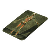 Diep Musculair Systeem aan de achterkant van het l Magneet (Linkerzijde)