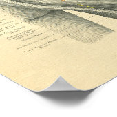  diepvriesanatomie van Hip & been Poster (Hoek)