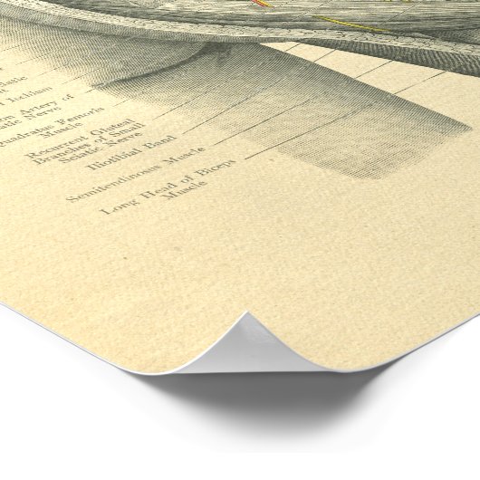  diepvriesanatomie van Hip & been Poster (Hoek)