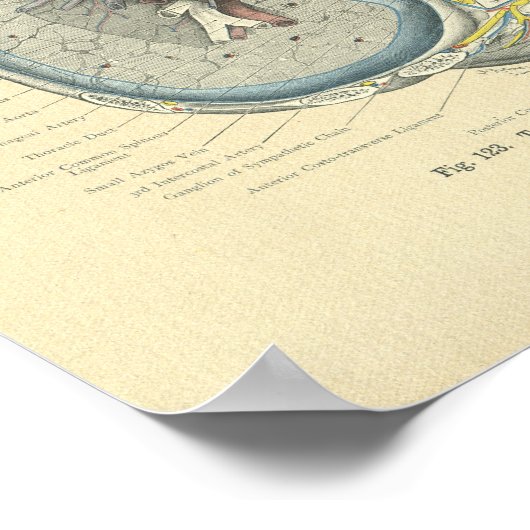  diepvriesdoorsnede poster (Hoek)