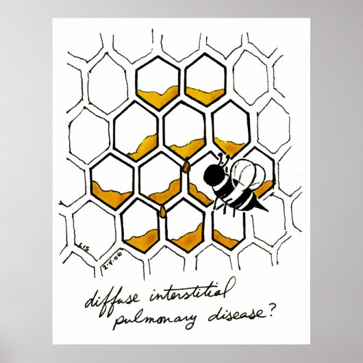 Diffuse Interstitiële longziekte Poster (Voorkant)