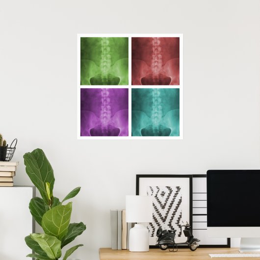 Digitaal X-Ray Pop Art Square Poster (Thuiskantoor)