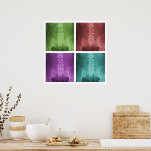 Digitaal X-Ray Pop Art Square Poster (Keuken)