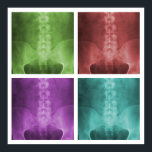Digitaal X-Ray Pop Art Square Poster<br><div class="desc">Het ontwerp kenmerkt vier verschillende gekleurde versies van een digitaal verbeterde en opgerolde ap lumbopelvic röntgenstraal.</div>