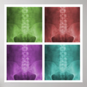 Digitaal X-Ray Pop Art Square Poster (Voorkant)