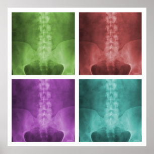 Digitaal X-Ray Pop Art Square Poster