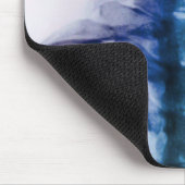 Digitale baarmoederlijke röntgenkunst muismat (Hoek)