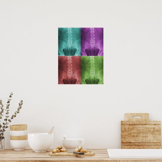 Digitale röntgenfoto poster (Keuken)