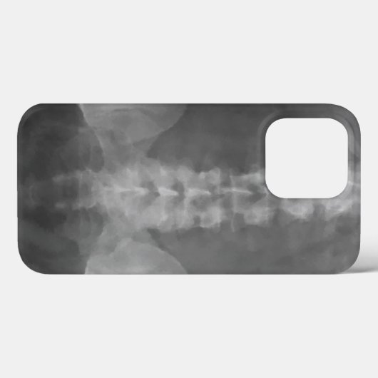 Digitale röntgenfoto's Case-Mate iPhone case (Achterkant (horizontaal))