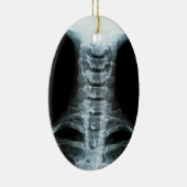 Digitale röntgenkunst (aangepaste achtertekst) keramisch ornament (Rechts)