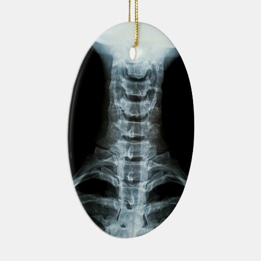 Digitale röntgenkunst (aangepaste achtertekst) keramisch ornament (Rechts)