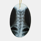 Digitale röntgenkunst (aangepaste achtertekst) keramisch ornament (Links)