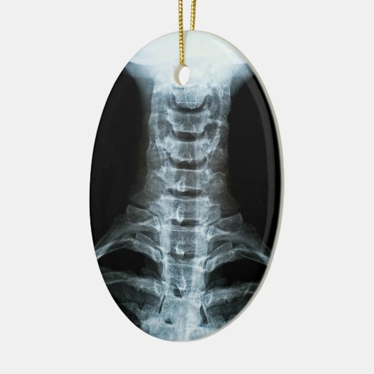 Digitale röntgenkunst (aangepaste achtertekst) keramisch ornament (Links)