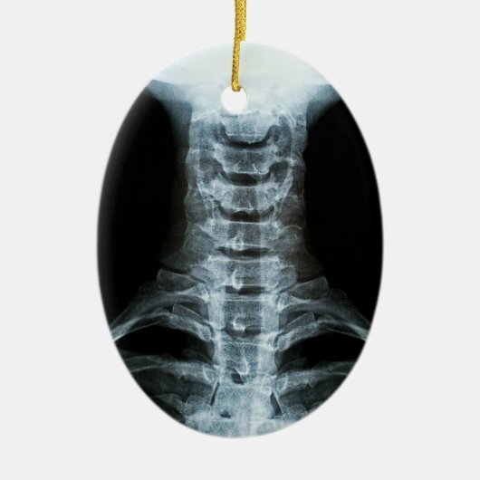 Digitale röntgenkunst (aangepaste achtertekst) keramisch ornament (Voorkant)