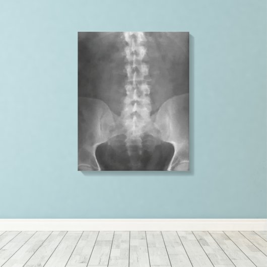 Digitale röntgenkunst verpakt canvas (Insitu (Houten vloer))