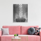 Digitale röntgenkunst verpakt canvas afdruk (Insitu (Woonkamer))