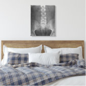 Digitale röntgenkunst verpakt canvas afdruk (Insitu (Slaapkamer))