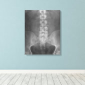 Digitale röntgenkunst verpakt canvas afdruk (Insitu (Houten vloer))